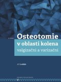 : Osteotomie v oblasti kolena: valgizační a varizační