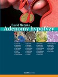 Netuka David: Adenomy hypofýzy