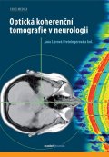 kolektiv autorů: Optická koherenční tomografie v neurologii
