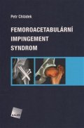 Chládek Petr: Femoroacetabulární impingement syndrom