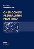 Musil Jaroslav: Onemocnění pleurálního prostoru