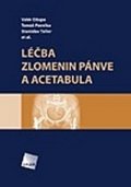 Džupa Valér: Léčba zlomenin pánve a acetabula