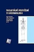 Kolombo Ivan: Skeletální postižení v uroonkologii