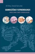 Slíva Jiří: Samoléčba v gynekologii aneb Sama sobě gynekologem