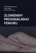 Krbec Martin: Zlomeniny proximálního femuru