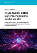 Nytrová Petra: Neuromyelitis optica a poruchy jejího širšího spektra