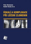 Wendsche Peter: Úskalí a komplikace při léčení zlomenin