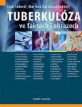 Koziar Vašáková Martina: Tuberkulóza ve faktech i obrazech