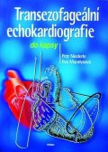 Niederle Petr: Transezofageální echokardiografie do kapsy