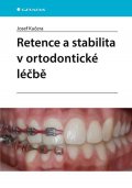 Kučera Josef: Retence a stabilita v ortodontické léčbě