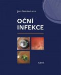 Nekolová Jana: Oční infekce