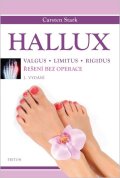 Stark Carsten: Hallux - Řešení bez operace