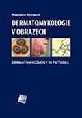 Skořepová Magdalena: Dermatomykologie v obrazech - Dermatomycology in Pictures