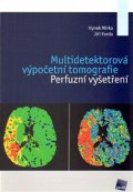 Ferda Jiří: Multidetektorová výpočetní tomografie - Perfuzní vyšetření