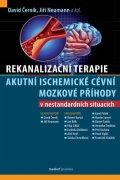 : Rekanalizační terapie akutní ischemické cévní mozkové příhody v nestandardn