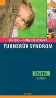 Lebl Jan: Turnerův syndrom