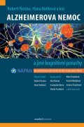 Rusina Robert: Alzheimerova nemoc a jiné kognitivní poruchy - Mezioborová doporučení pro k