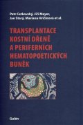 Cetkovský Petr: Transplantace kostní dřeně a periferních hematopoetických buněk