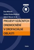 Míšová Eva: Projevy vzácných onemocnění v orofaciální oblasti