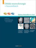 Homolková Helena a kolektiv: Dětská neurochirurgie v kazuistikách