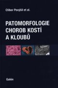 Povýšil Ctibor: Patomorfologie chorob kostí a kloubů