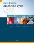 Novák Zdeněk: Arachnoid cysts - Arachnoidální cysty mozku a míchy