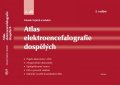 Vojtěch Zdeněk: Atlas elektroencefalografie dospělých 2. díl