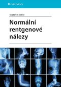 Möller Torsten B.: Normální rentgenové nálezy