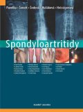 kolektiv autorů: Spondyloartritidy